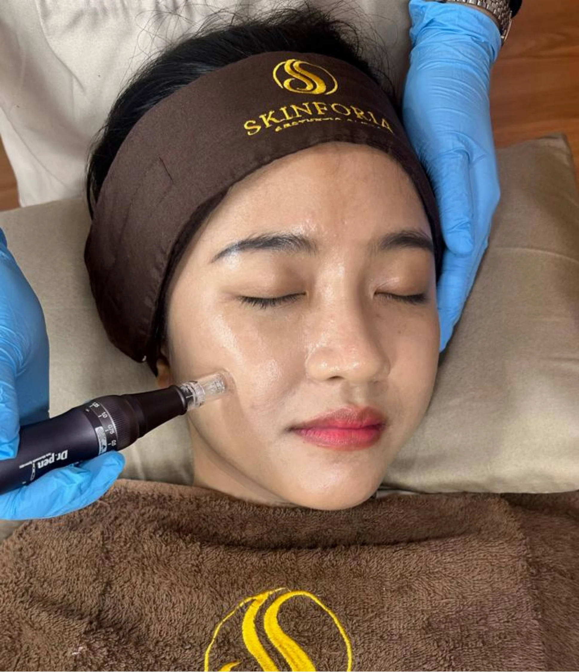 Microneedling