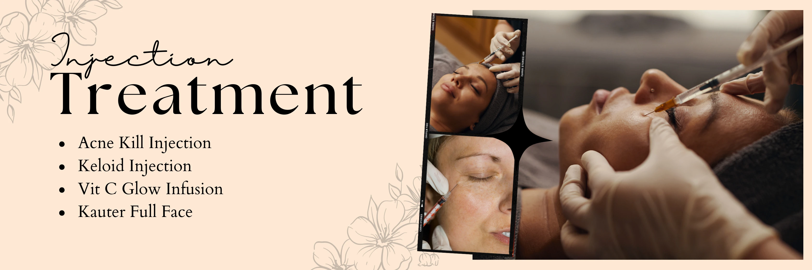 banner-treatment